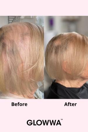 Hair Loss Supplements Hungerford Hair Loss Supplements Hungerford