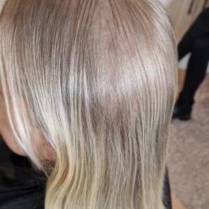 Female Pattern Baldness In Women Near Me