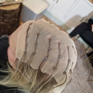 Hair Loss Solutions, Hungerford Hair Loss Clinic