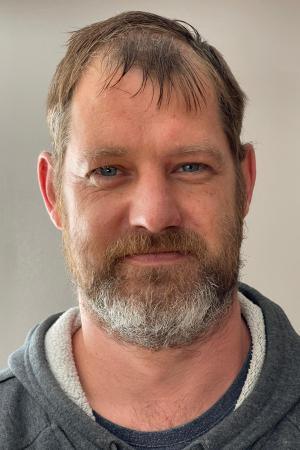 Stress Related Hair Loss  Hungerford