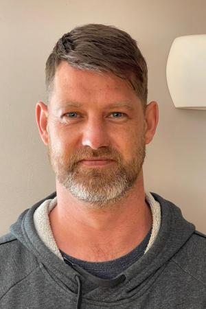 Hair Loss Solutions For Common Hair Loss & Scalp Conditions Near Me
