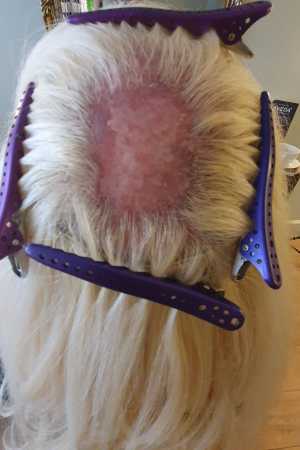 Hair Loss Experts Near Me
