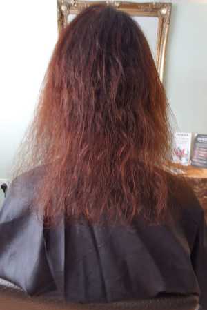 hair loss clinic in Hungerford