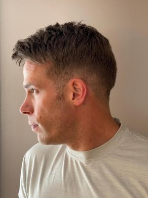 Male  Pattern Baldness Solutions Hungerford