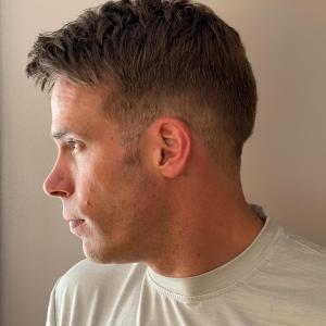 Male  Pattern Baldness Solutions Hungerford