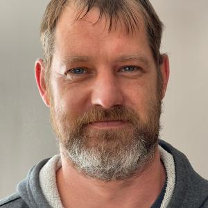 Stress Related Hair Loss  Hungerford