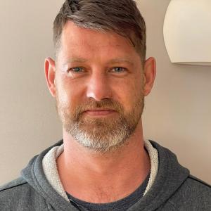 Hair Loss Solutions For Common Hair Loss & Scalp Conditions Near Me