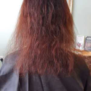 hair loss clinic in Hungerford